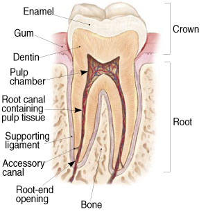 root canal 