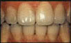 gum disease treatment :: gum pain treatment